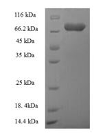 Human Autophagy-related protein 16-1 (ATG16L1) Recombinant Protein, N-His-SUMO - BioCrest Sci