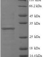 Human Histone H3.3 (H3F3A), partial Recombinant Protein, N-His-SUMO - BioCrest Sci