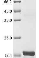 Mouse Natriuretic peptides B (Nppb) Recombinant Protein - BioCrest Sci