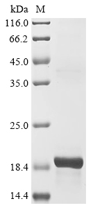 Mouse Natriuretic peptides B (Nppb) Recombinant Protein, Mus musculus (Mouse), E.coli, N-terminal 10xHis-tagged and C-terminal Myc-tagged, 18.3 kDa, purity >≥ 85% as determined by SDS-PAGE.