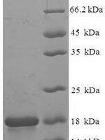 Macaca fascicularis Frataxin, mitochondrial (FXN) Recombinant Protein - BioCrest Sci