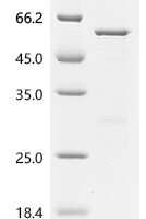 Human Z-DNA-binding protein 1 (ZBP1) Recombinant Protein, N-10His - BioCrest Sci