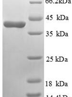 Mouse Glucagon receptor (Gcgr), partial Recombinant Protein, N-GST - BioCrest Sci