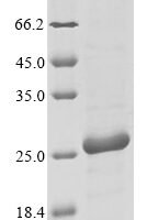 Apium graveolens Major allergen Api g 1, isoallergen 2 Recombinant Protein, N-His, aa 1–159, E.coli - BioCrest Sci