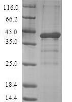 Human Appetite-regulating hormone (GHRL) Recombinant Protein - BioCrest Sci