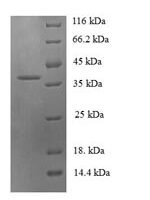 Human C-C motif chemokine 19 (CCL19) Recombinant Protein - BioCrest Sci