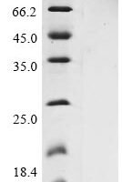 Avian infectious bronchitis virus Non-structural protein 3b (3b) Recombinant Protein, C-His - BioCrest Sci