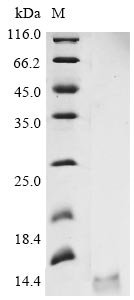 Avian infectious bronchitis virus Non-structural protein 3b (3b) Recombinant Protein, C-His, Avian infectious bronchitis virus (strain UK/68/84) (IBV), Yeast, C-terminal 6xHis-tagged, 8.8 kDa, purity >≥ 90% as determined by SDS-PAGE.
