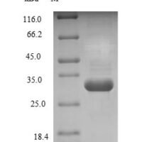 Human Glutathione S-transferase P (GSTP1) Recombinant Protein, N-His - BioCrest Sci