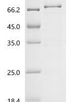 Prunus persica non-specific serine/threonine protein kinase Recombinant Protein, C-10His - BioCrest Sci