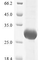 Human Granulocyte colony-stimulating factor receptor (CSF3R), partial Recombinant Protein, N-His - BioCrest Sci