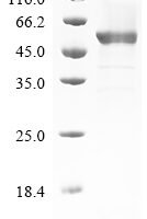 Horse Fibrinogen beta chain (FGB) Recombinant Protein - BioCrest Sci