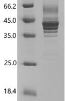 Human MHC class I polypeptide-related sequence B (MICB), partial Recombinant Protein, N-His, aa 23–309 - BioCrest Sci