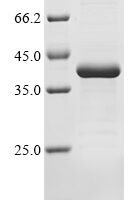 Human Chymotrypsin-like elastase family member 2B (CELA2B) Recombinant Protein - BioCrest Sci