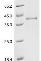 Human Cathepsin L2 (CTSV) Recombinant Protein - BioCrest Sci