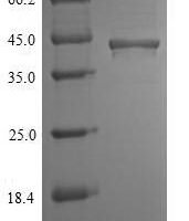 Mouse Chitinase domain-containing protein 1 (Chid1) Recombinant Protein, N-His, aa 20–393, Baculovirus - BioCrest Sci
