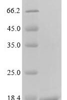 Human Platelet glycoprotein Ib alpha chain (GP1BA), partial Recombinant Protein, N-10His/C-Myc - BioCrest Sci