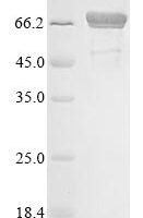Escherichia coli Chaperone protein DnaK (dnaK) Recombinant Protein - BioCrest Sci