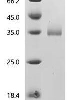 Macaca fascicularis neutrophil elastase isoform X1 (Elane) Recombinant Protein - BioCrest Sci