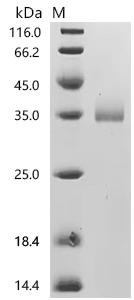 Macaca fascicularis neutrophil elastase isoform X1 (Elane) Recombinant Protein, Mammalian cell, C-terminal 10xHis-tagged, 31.9 kDa, purity >≥ 95% as determined by SDS-PAGE.