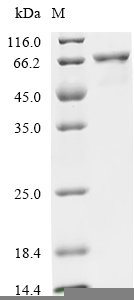 Candida albicans Secreted aspartic protease 9 (SAP9) Recombinant Protein, N-His-PDI, Candida albicans (Yeast), Yeast, N-terminal 6xHis-PDI-tagged, 115.8 kDa, purity >≥ 85% as determined by SDS-PAGE.