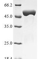 Listeria monocytogenes serotype 4b Internalin A (inlA), partial Recombinant Protein - BioCrest Sci