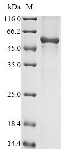 Human Keratin, type I cuticular Ha4 (KRT34) Recombinant Protein, N-10His/C-Myc, aa 1–436, E.coli, Homo sapiens (Human), E.coli, N-terminal 10xHis-tagged and C-terminal Myc-tagged, 56.9 kDa, purity >≥ 85% as determined by SDS-PAGE.