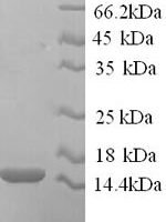 Human RING-box protein 2 (RNF7) Recombinant Protein, N-His - BioCrest Sci