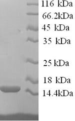 Human RING-box protein 2 (RNF7) Recombinant Protein, N-His, Homo sapiens (Human), Yeast, N-terminal 6xHis-tagged, 14.6 kDa, purity >≥ 90% as determined by SDS-PAGE.