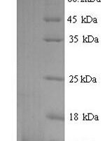 Bovine C-C motif chemokine 20 (CCL20) Recombinant Protein, N-His - BioCrest Sci