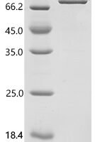 Human Hypoxia-inducible factor 1-alpha (HIF1A), partial, Biotinylated Recombinant Protein - BioCrest Sci