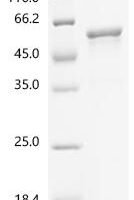 Human Hydroxymethylglutaryl-CoA synthase, mitochondrial (HMGCS2) Recombinant Protein - BioCrest Sci