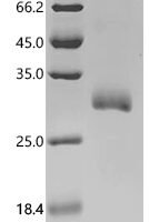 Human Butyrophilin subfamily 3 member A1 (BTN3A1), partial Recombinant Protein, C-10His - BioCrest Sci