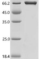 Human Suprabasin (SBSN) Recombinant Protein, C-His, aa 26–590, E.coli - BioCrest Sci