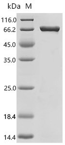 Human Suprabasin (SBSN) Recombinant Protein, C-His, aa 26–590, E.coli, Homo sapiens (Human), E.coli, C-terminal 6xHis-tagged, 64.9 kDa, purity >≥ 85% as determined by SDS-PAGE.