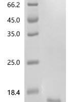 Human Protein GPR15LG (GPR15LG) Recombinant Protein - BioCrest Sci