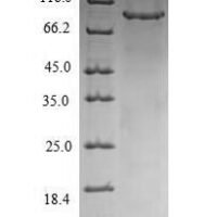Human Rab proteins geranylgeranyltransferase component A 1 (CHM) Recombinant Protein - BioCrest Sci