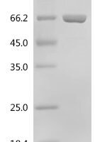 Human Calcium-binding protein 39(CAB39) Recombinant Protein - BioCrest Sci