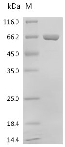 Human Calcium-binding protein 39(CAB39) Recombinant Protein, Homo sapiens (Human), E.coli, N-terminal 6xHis-tagged and C-terminal GFP-tagged, 67.7 kDa, purity >≥ 95% as determined by SDS-PAGE.
