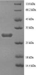 Human Peptide YY protein (PYY), partial Recombinant Protein, N-GST, Homo sapiens (Human), E.coli, N-terminal GST-tagged, 31.1 kDa, purity >≥ 90% as determined by SDS-PAGE.