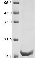 Human Proton-coupled zinc antiporter SLC30A8 (SLC30A8), partial Recombinant Protein, N-10His/C-Myc - BioCrest Sci