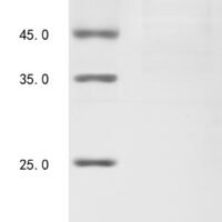 Human Adenylate kinase 7 (AK7) Recombinant Protein, N-10His - BioCrest Sci