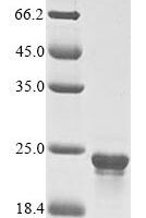 Cyanophora paradoxa Chaperone protein dnaK (dnaK-A), partial Recombinant Protein - BioCrest Sci