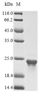 Cyanophora paradoxa Chaperone protein dnaK (dnaK-A), partial Recombinant Protein, Cyanophora paradoxa, E.coli, N-terminal 10xHis-tagged and C-terminal Myc-tagged, 21.9 kDa, purity >≥ 85% as determined by SDS-PAGE.