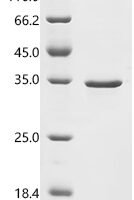 Human Transcriptional enhancer factor TEF-3 (TEAD4), Partial Recombinant Protein, N-His/C-His - BioCrest Sci