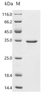 Human Transcriptional enhancer factor TEF-3 (TEAD4), Partial Recombinant Protein, N-His/C-His, Homo sapiens (Human), E.coli, N-terminal 6xHis-tagged and C-terminal 6xHis-tagged, 35.5 kDa, purity >≥ 90% as determined by SDS-PAGE.
