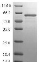 Human Fructose-1,6-bisphosphatase 1 (FBP1) Recombinant Protein - BioCrest Sci