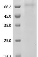 Human 5-hydroxytryptamine receptor 3A (HTR3A), Biotinylated-Detergent Recombinant Protein - BioCrest Sci