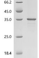Human LIM domain-binding protein 1(LDB1),partial Recombinant Protein - BioCrest Sci