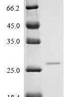 Human Ras-related protein Rab-6B (RAB6B) Recombinant Protein, C-10His - BioCrest Sci